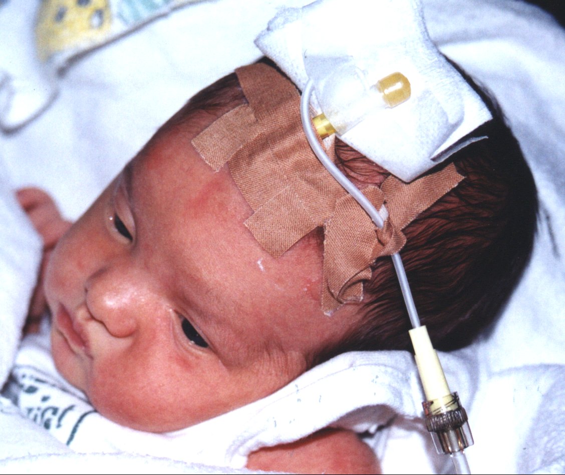 girl-hospital.jpg - 165kb